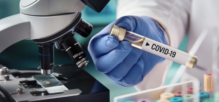 Bélgica dona a Bolivia 10.000 test de diagnóstico para el Covid-19